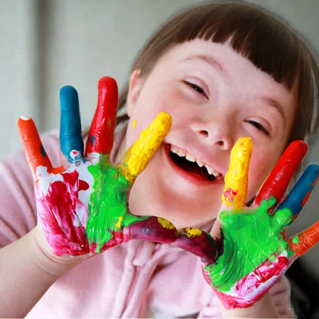 A young girl with Down syndrome laughing, her palms covered in finger paint.